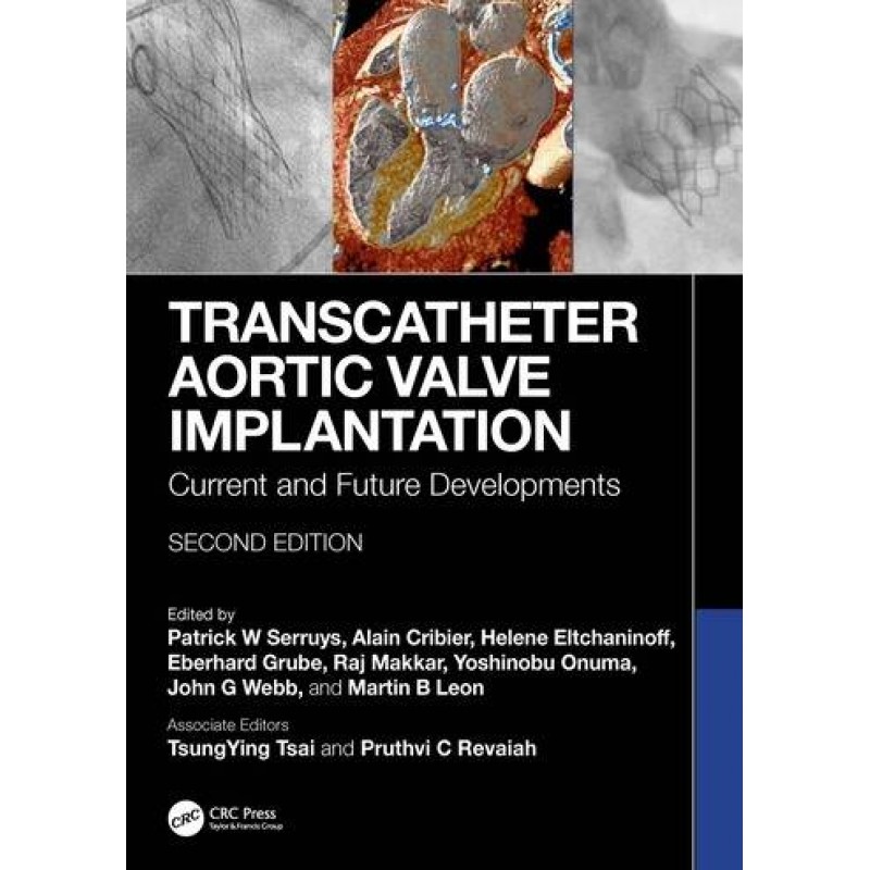 Transcatheter Aortic Valve Implantation. Current and Future Developments 2nd Edition