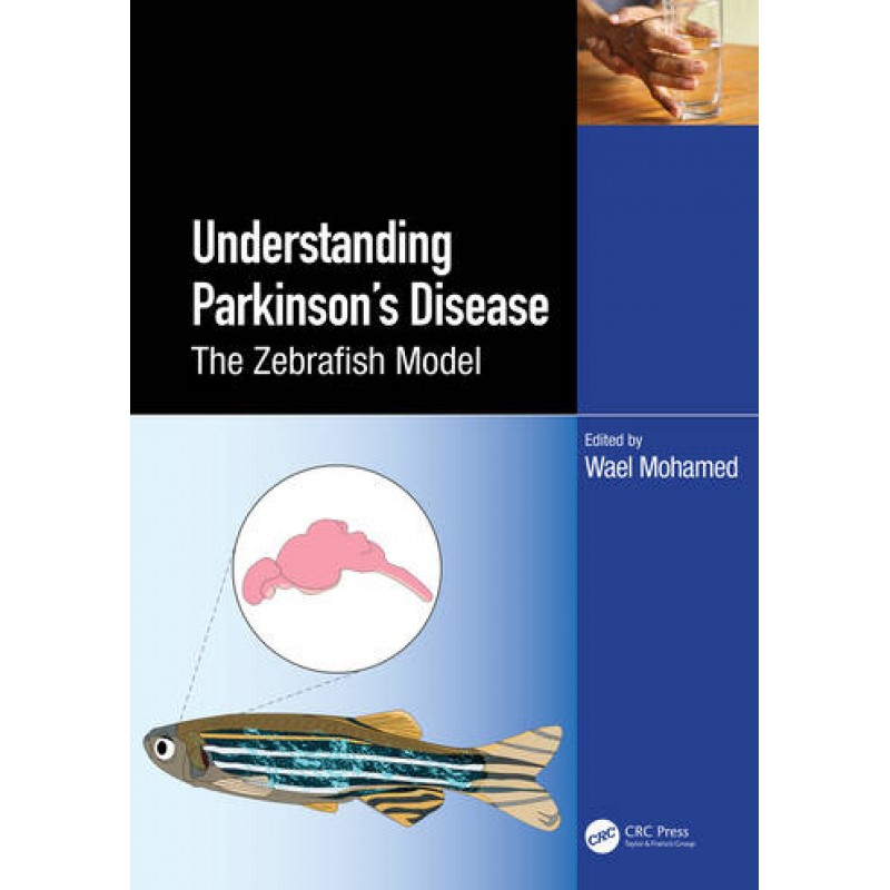 Zebrafish as a Model for Parkinson’s Disease