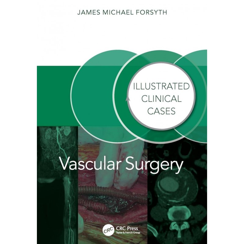 Vascular Surgery: Illustrated Clinical Cases