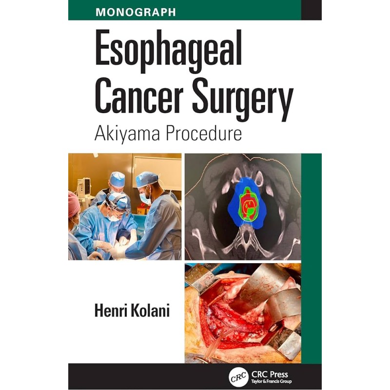 Esophageal Cancer Surgery. Akiyama Procedure