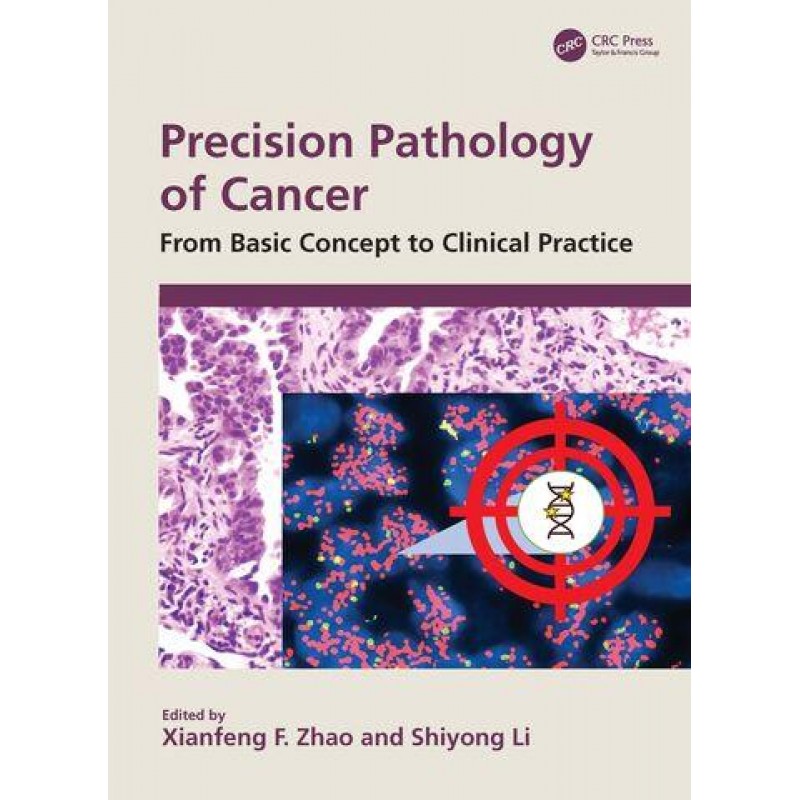 Precision Pathology of Cancer. From Basic Concept to Clinical Practice