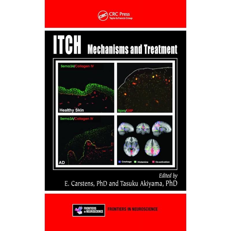 Itch. Mechanisms and Treatment