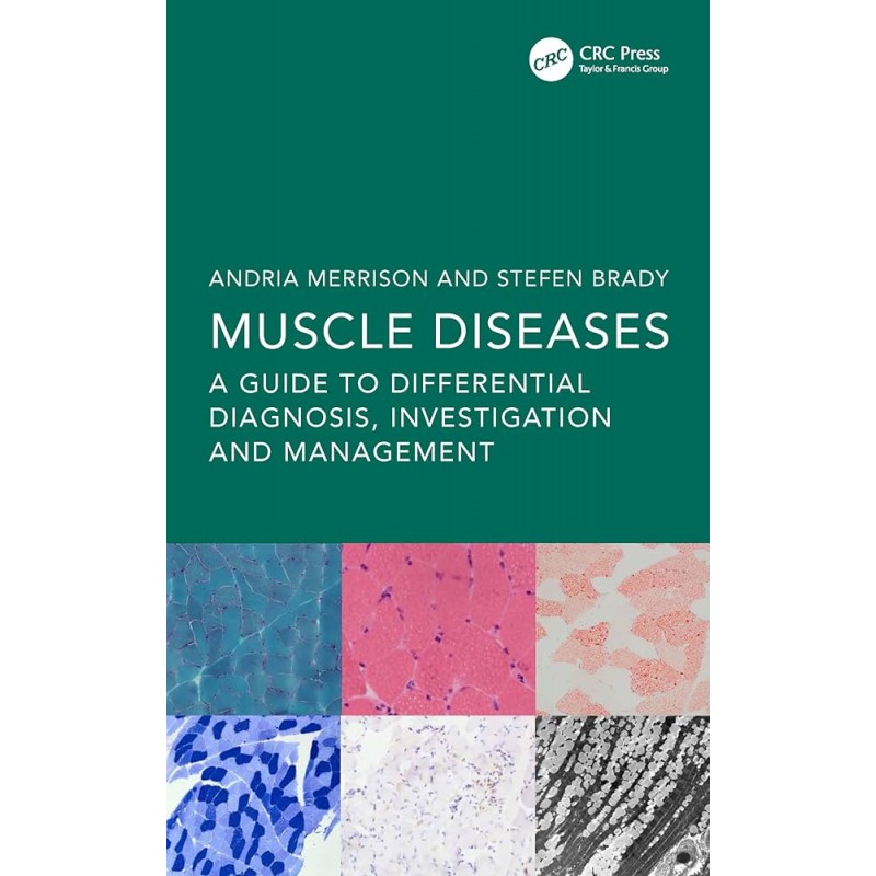 Muscle Diseases. A Guide to Differential Diagnosis, Investigation and Management