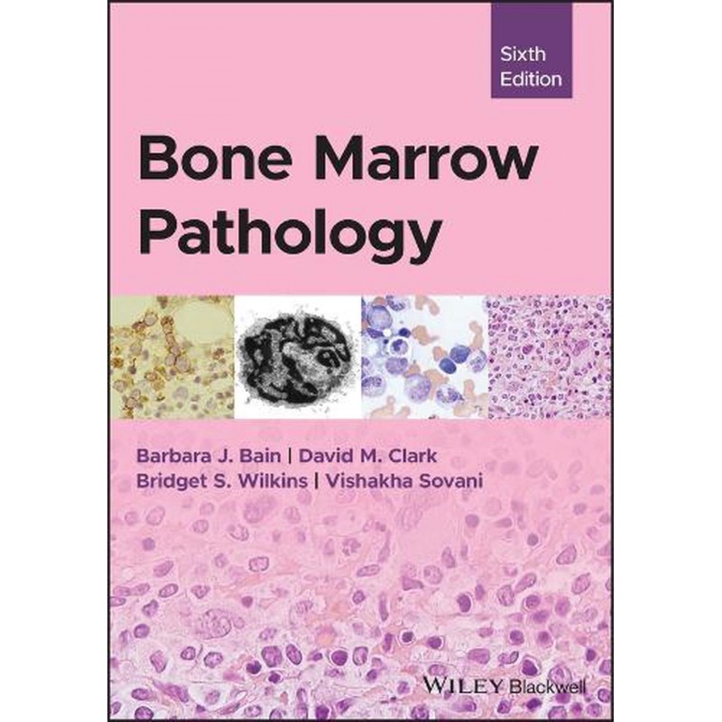 Bone Marrow Pathology, 6th Edition