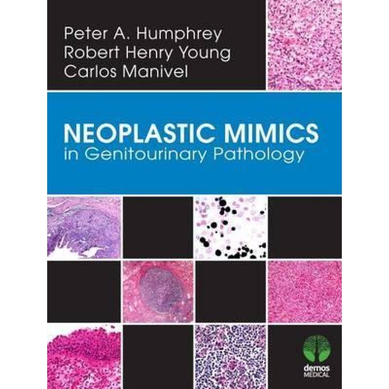 Neoplastic Mimics in Genitourinary Pathology