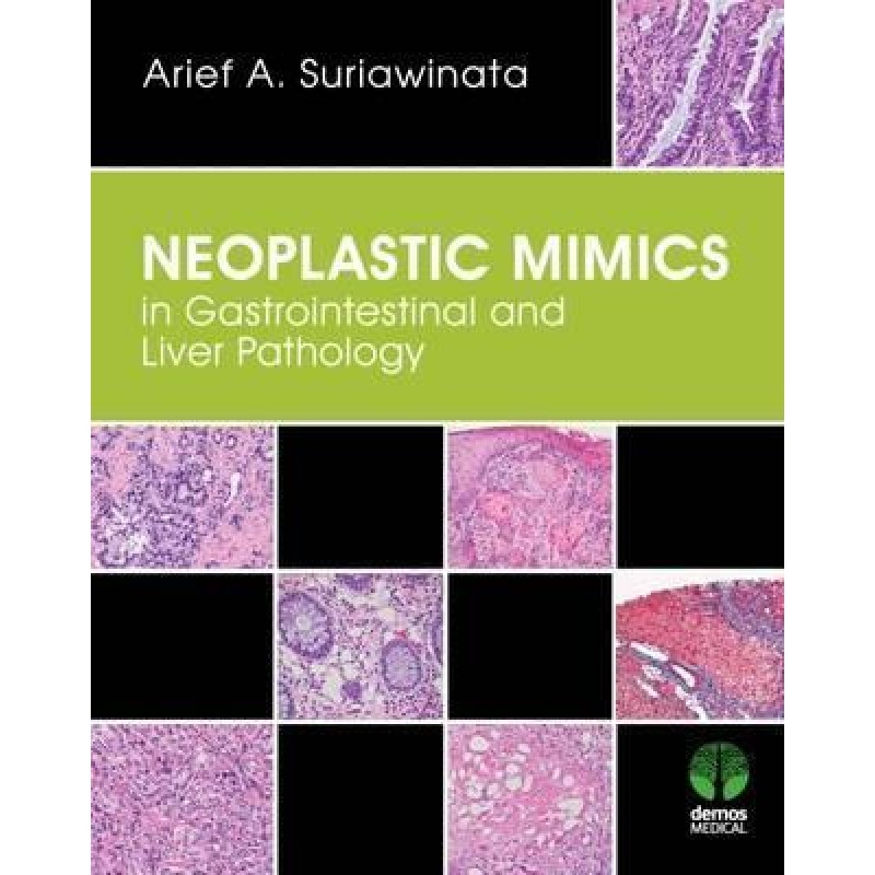 Neoplastic Mimics in Gastrointestinal and Liver Pathology