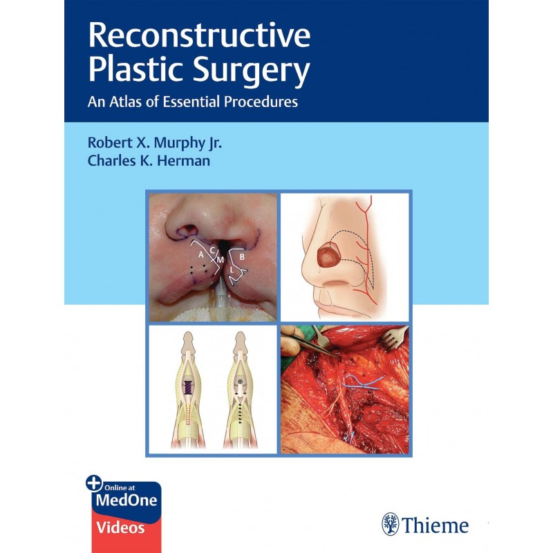 Reconstructive Plastic Surgery: An Atlas of Essential Procedures