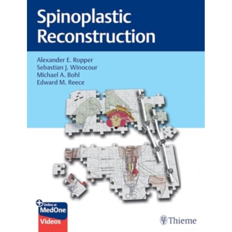 Spinoplastic Reconstruction