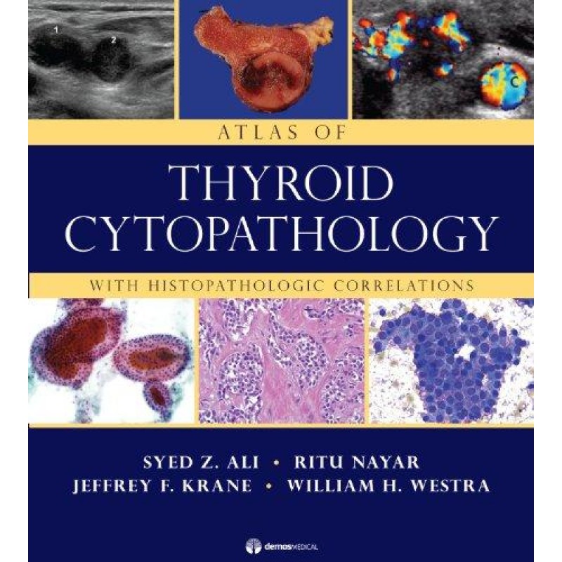 Atlas of Thyroid Cytopathology With Histopathologic Correlations