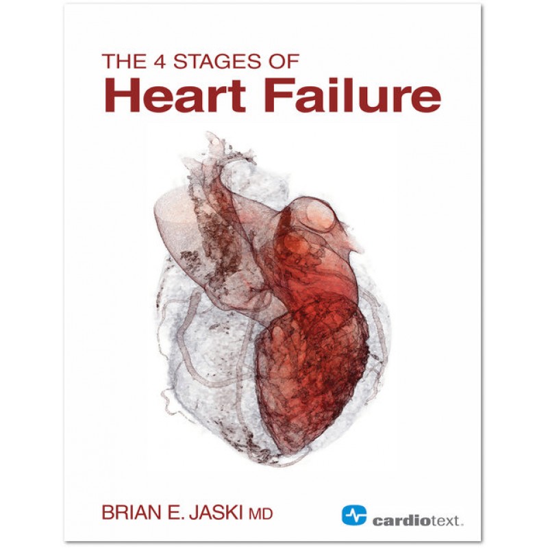 4 Stages of Heart Failure