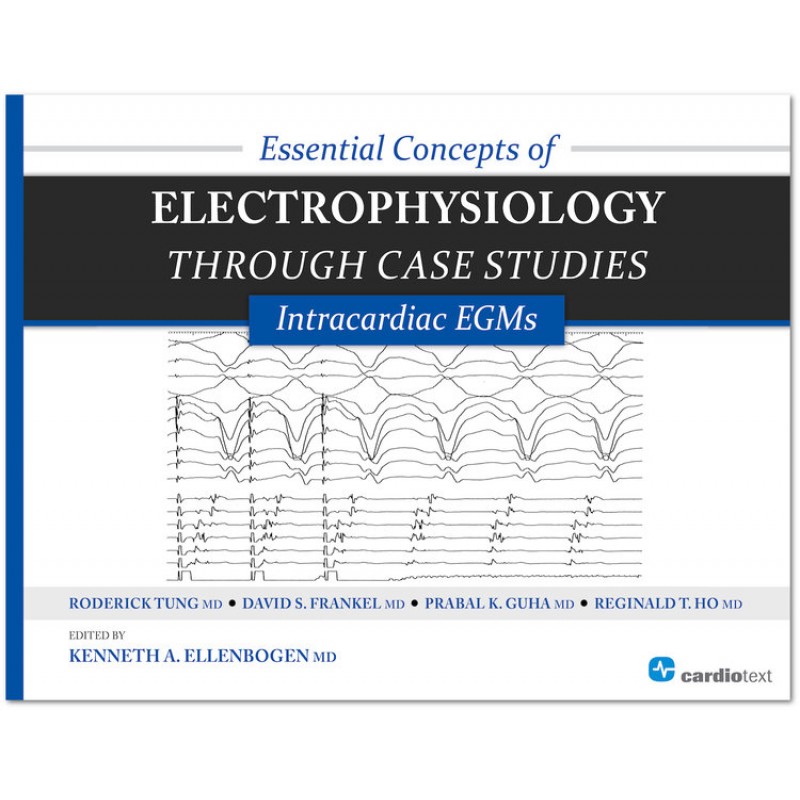 Essential Concepts of Electrophysiology through Case Studies: Intracardiac EGMs - Ellenbogen 