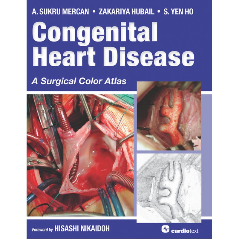 Congenital Heart Disease