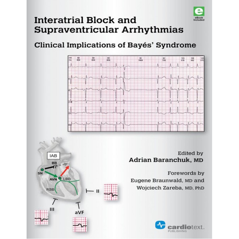 Interatrial Block and Supraventricular Arrhythmias