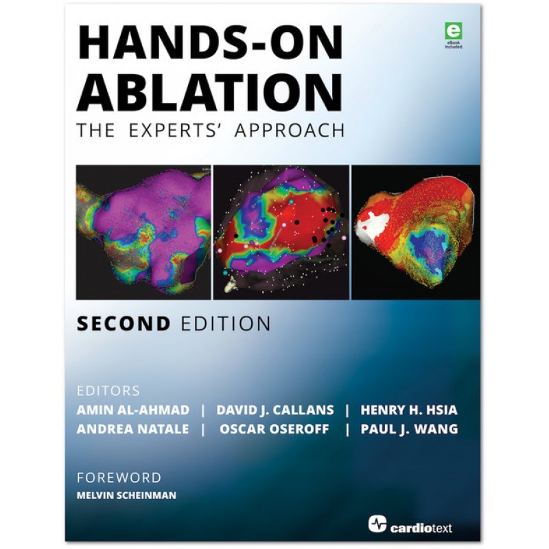 Hands-On Ablation, Second Edition