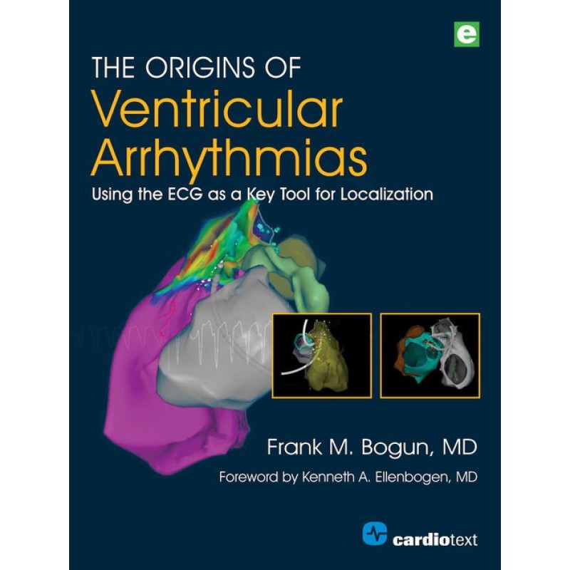 The Origins of Ventricular Arrhythmias