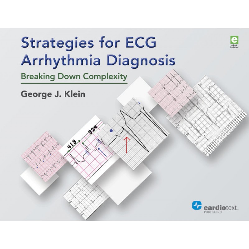 Strategies for ECG Arrhythmia Diagnosis 