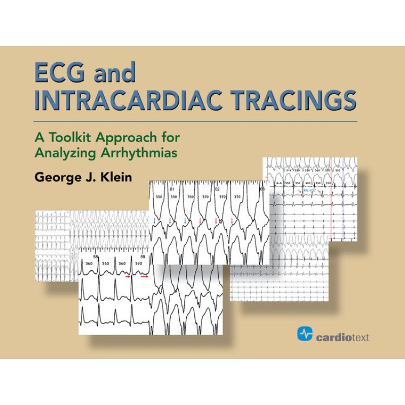 ECG and Intracardiac Tracings: A Toolkit Approach for Analyzing Arrhythmias