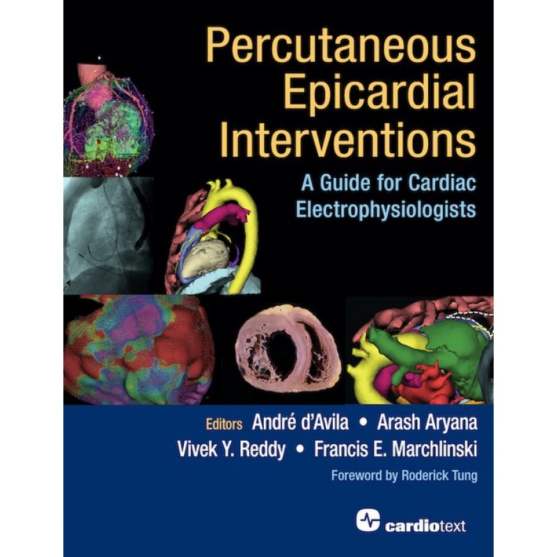 Percutaneous Epicardial Interventions: A Guide for Cardiac Electrophysiologists