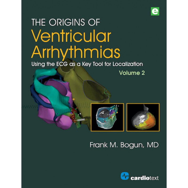 The Origins of Ventricular Arrhythmias, Volume 2