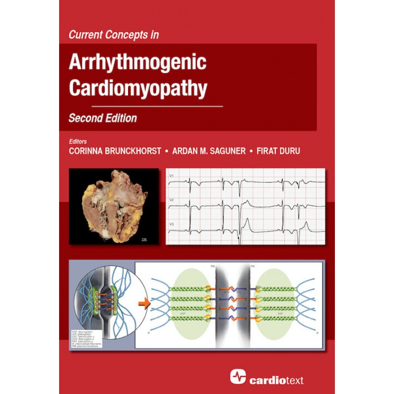 Current Concepts in Arrhythmogenic Cardiomyopathy, Second Edition