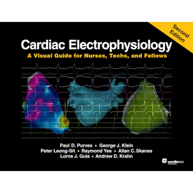 Cardiac Electrophysiology