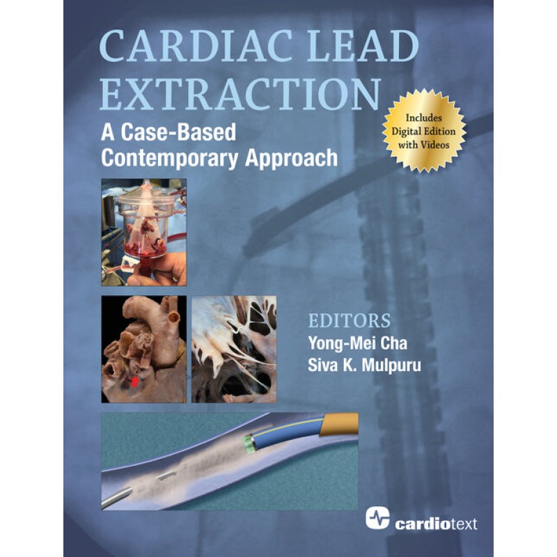 Cardiac Lead Extraction: A Case-Based Contemporary Approach