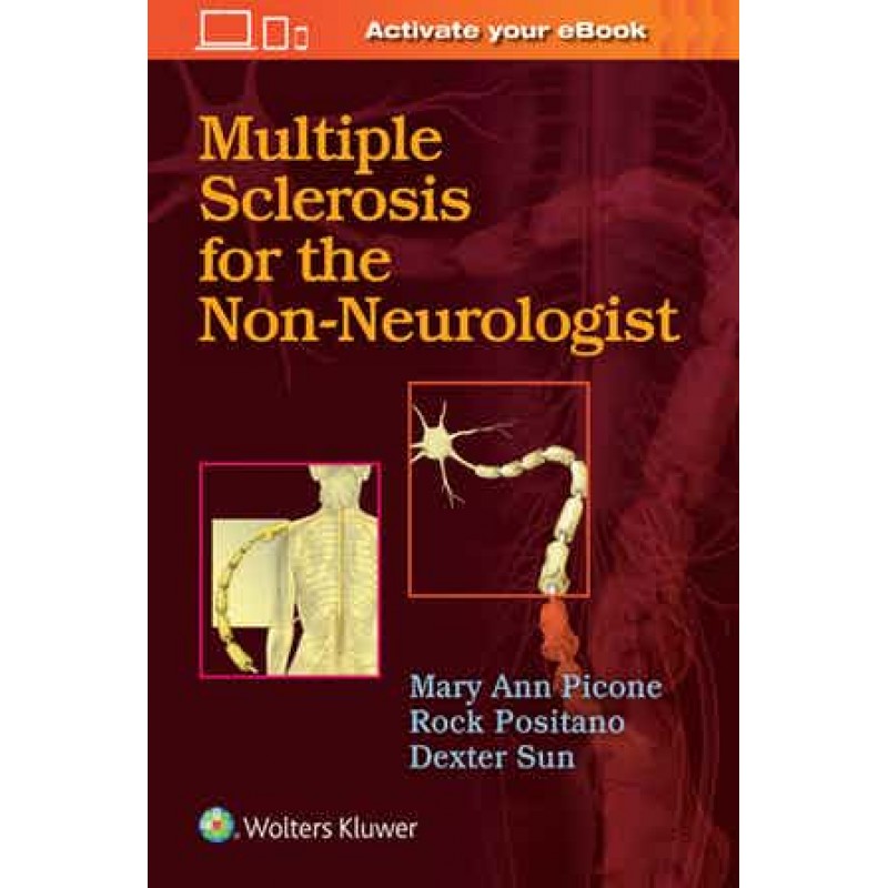 Multiple Sclerosis for the Non-Neurologist 1st edition