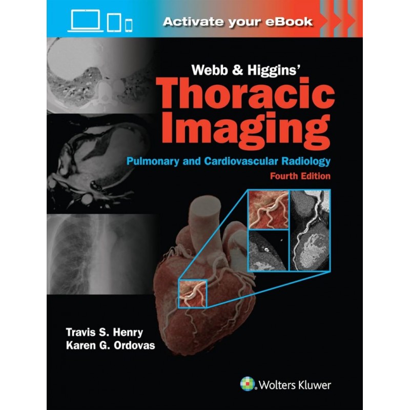 Webb & Higgins Thoracic Imaging: Print + eBook with Multimedia Fourth edition