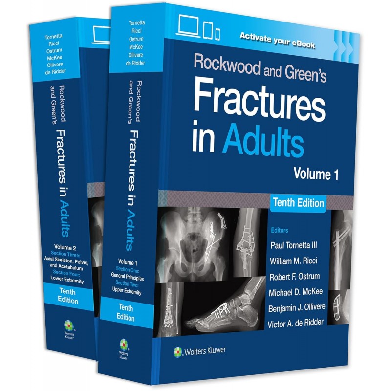 Rockwood and Green's Fractures in Adults: Print + eBook with Multimedia 10e