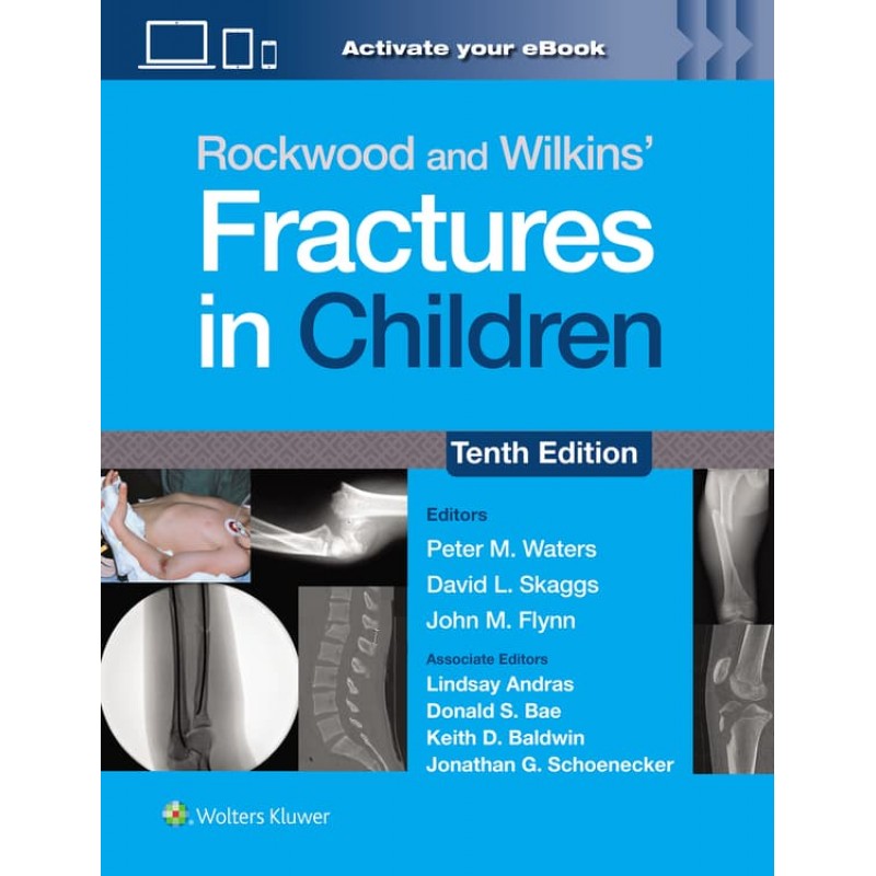 Rockwood and Wilkins’ Fractures in Children: Print + eBook with Multimedia Tenth edition