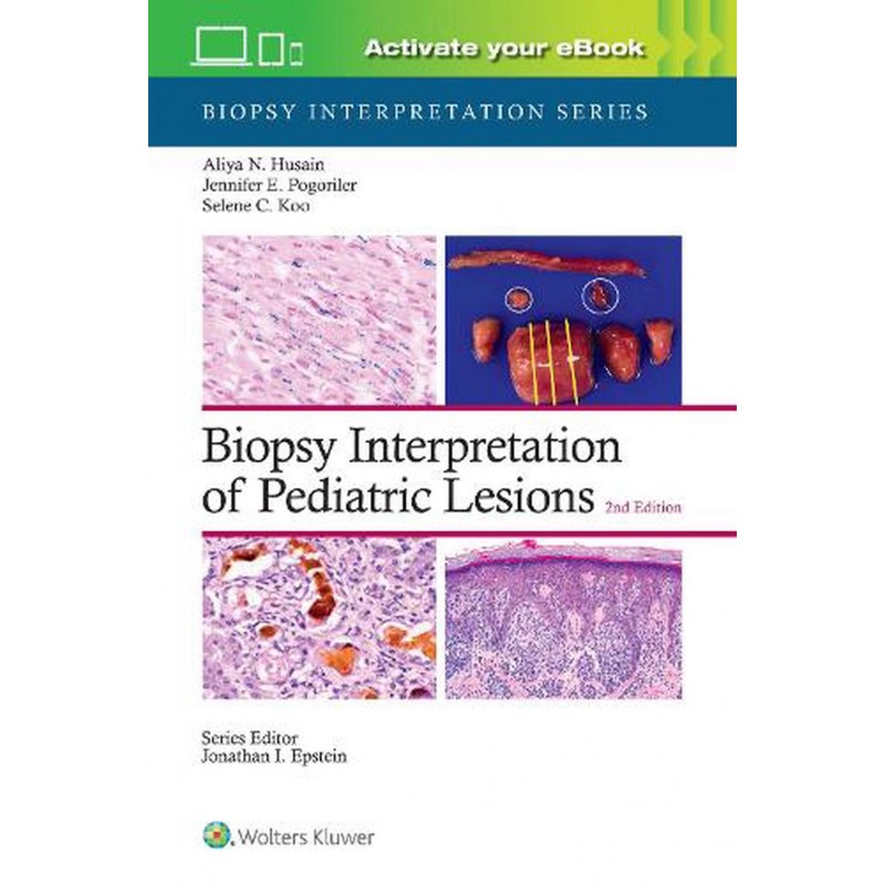 Biopsy Interpretation of Pediatric Lesions: Print + eBook with Multimedia Second edition