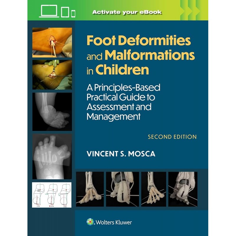 Foot Deformities and Malformations in Children A Principles-Based, Practical Guide to Assessment and Management: Print + eBook with Multimedia, Second edition