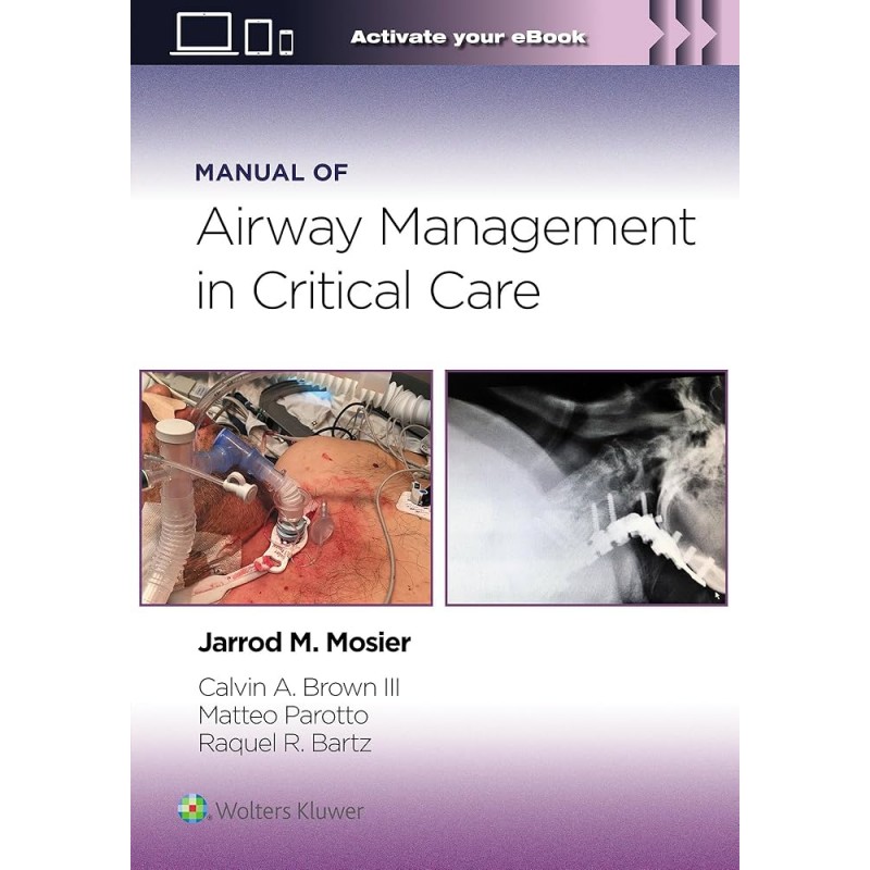 Manual of Airway Management in Critical Care: Print + eBook with Multimedia First edition