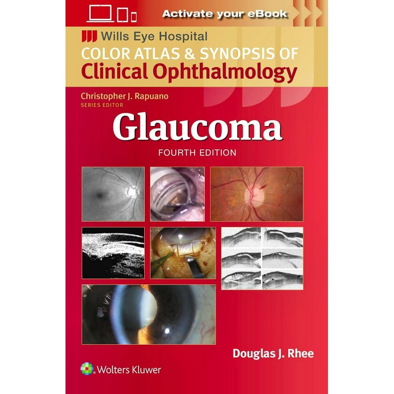 Wills Eye Hospital: Glaucoma Fourth edition