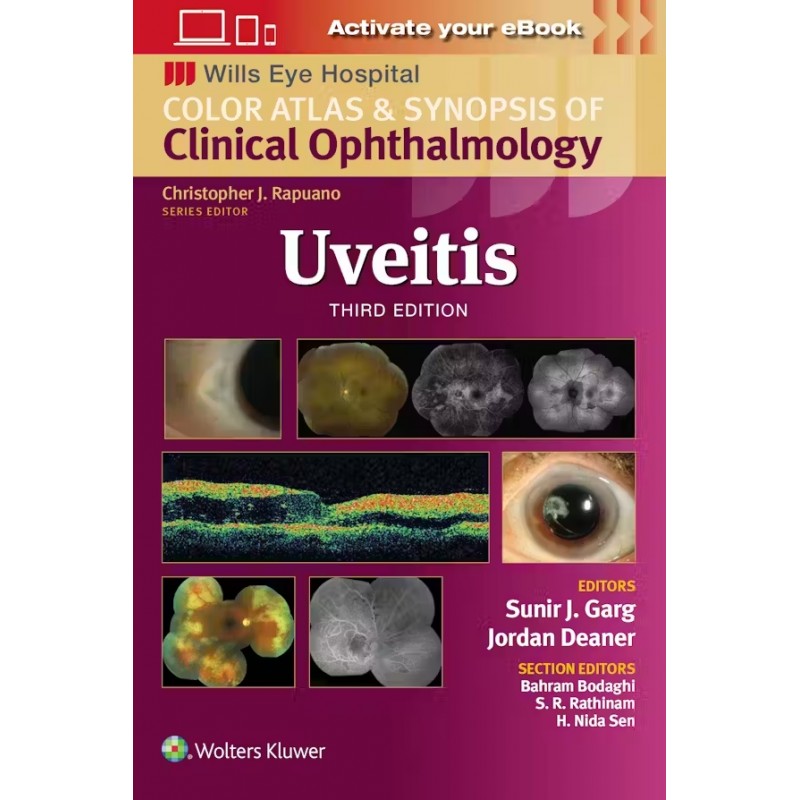 Wills Eye Hospital: Uveitis Third edition