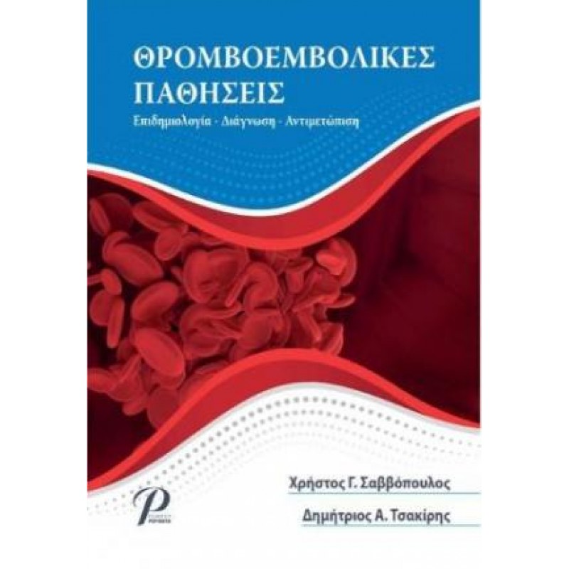 Θρομβοεμβολικές Παθήσεις: Επιδημιολογία, Διάγνωση, Αντιμετώπιση