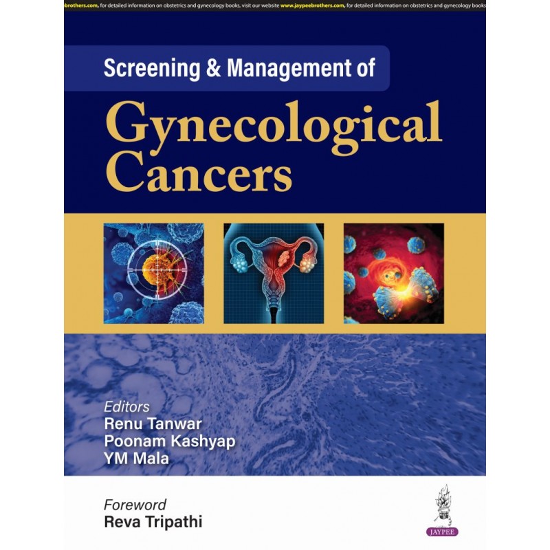 Screening & Management of Gynecological Cancers