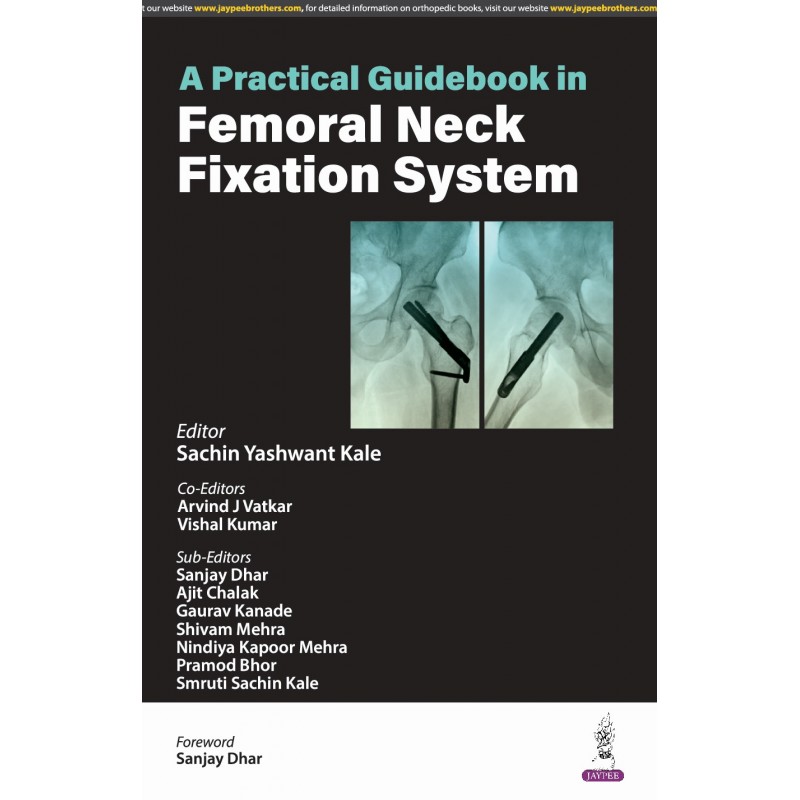 A Practical Guidebook in Femoral Neck Fixation System