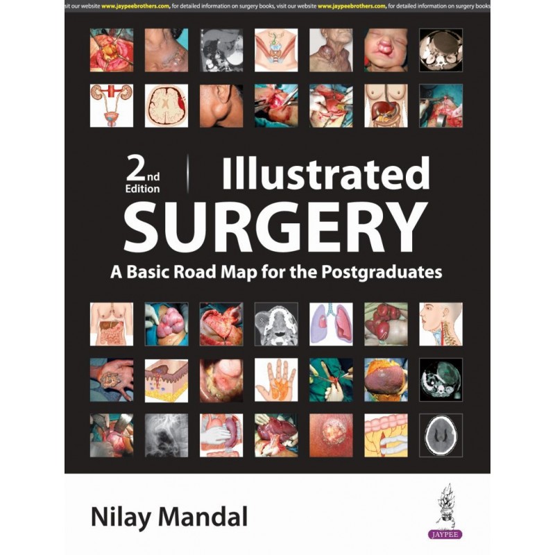 Illustrated Surgery: A Basic Roadmap for Postgraduates 2/e