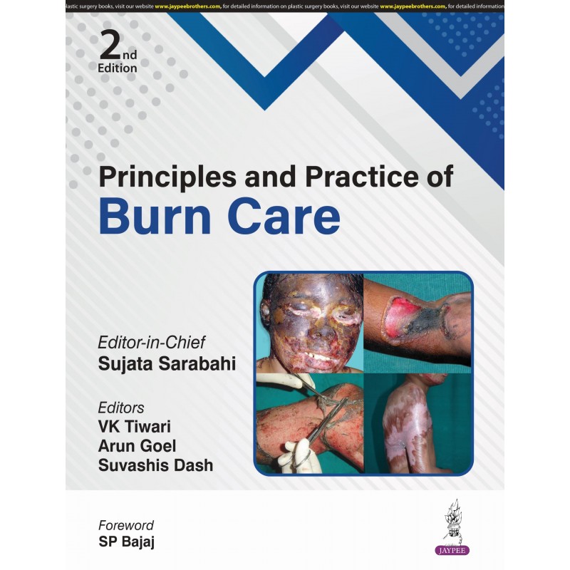 Principles and Practice of Burn Care 2/e