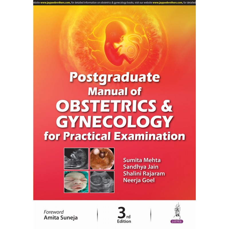 Postgraduate Manual of Obstetrics and Gynecology for Practical Examination 3/e