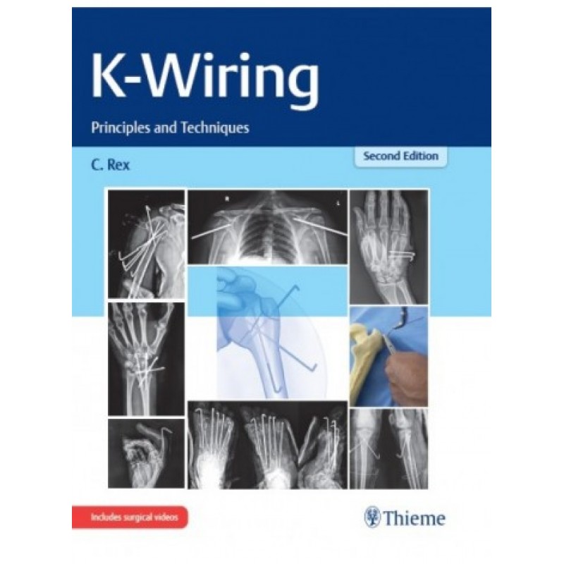 K-Wiring: Principles and Techniques, 2nd Edition