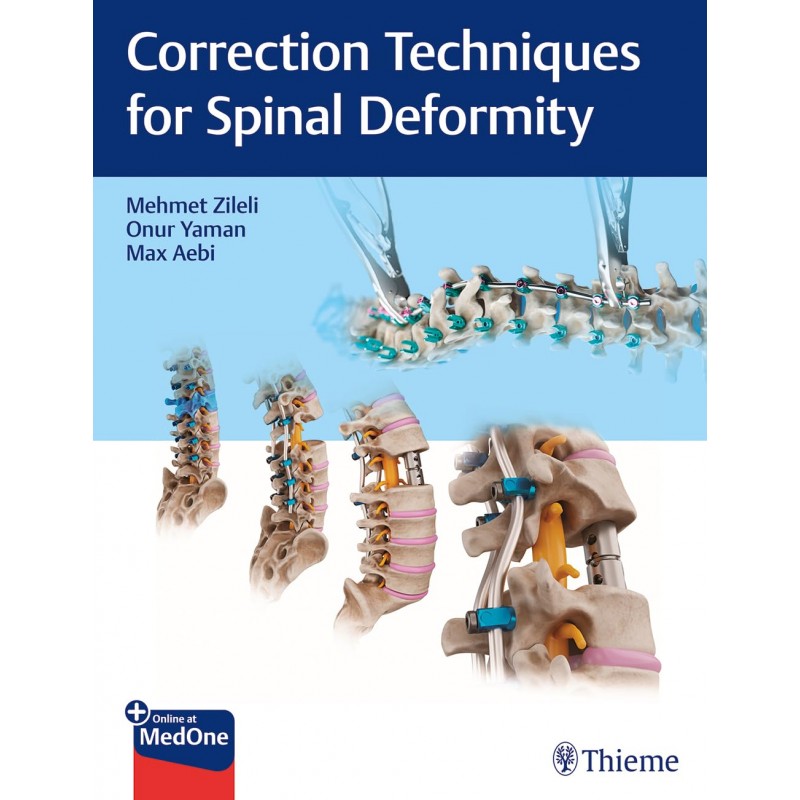 Correction Techniques for Spinal Deformity