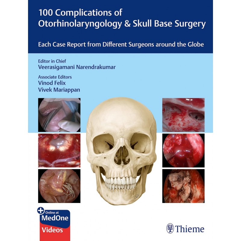 100 Complications of Otorhinolaryngology & Skull Base Surgery. Each Case Report from Different Surgeons around the Globe