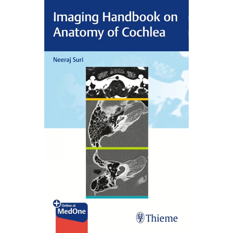 Imaging Handbook on Anatomy of Cochlea