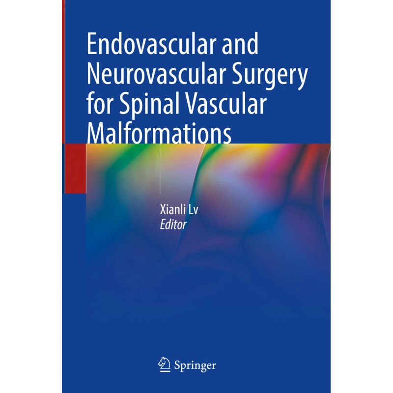 Endovascular and Neurovascular Surgery for Spinal Vascular Malformations