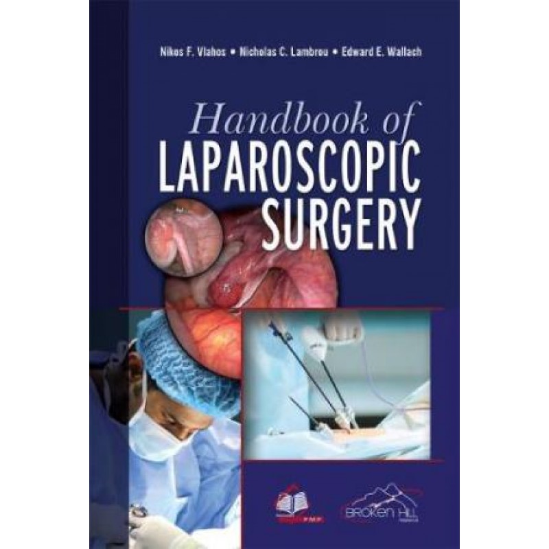 Handbook of Laparoscopic Surgery 2e