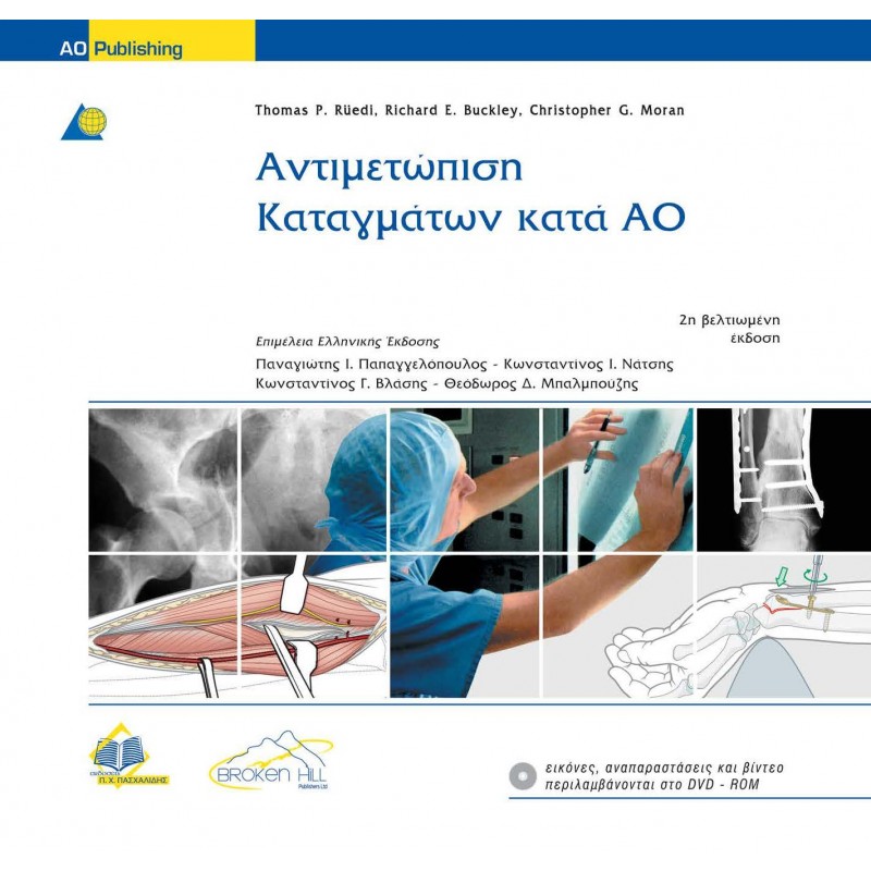 Αντιμετώπιση Καταγμάτων Κατά ΑΟ / 2 TOMOI