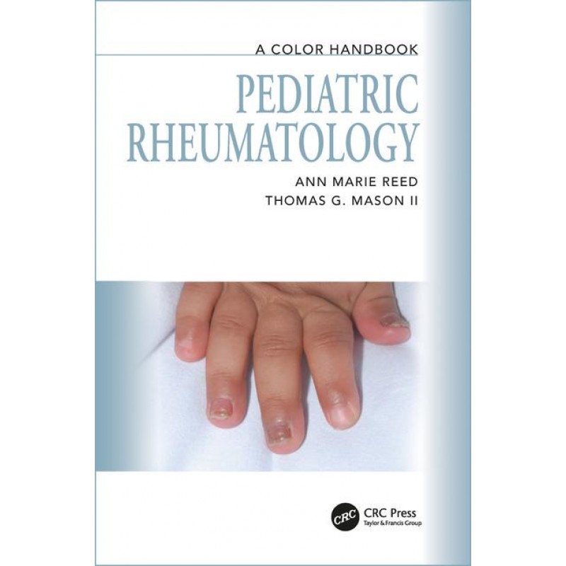 Pediatric Rheumatology: A Color Handbook