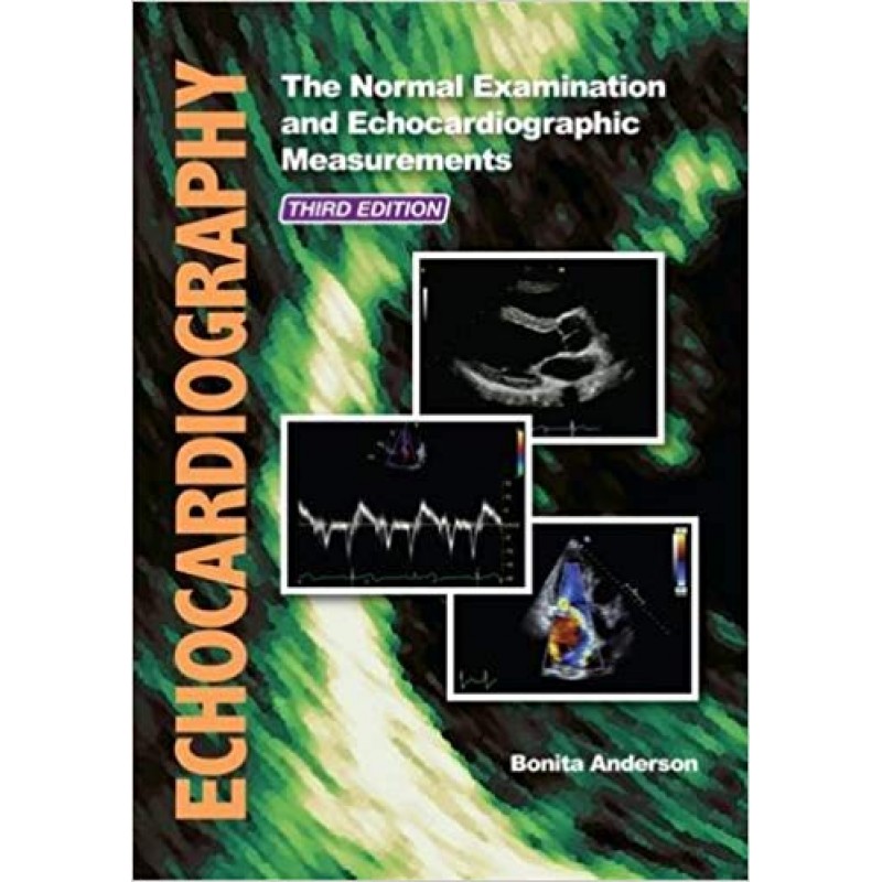 Echocardiography: The Normal Examination and Echocardiographic Measurements